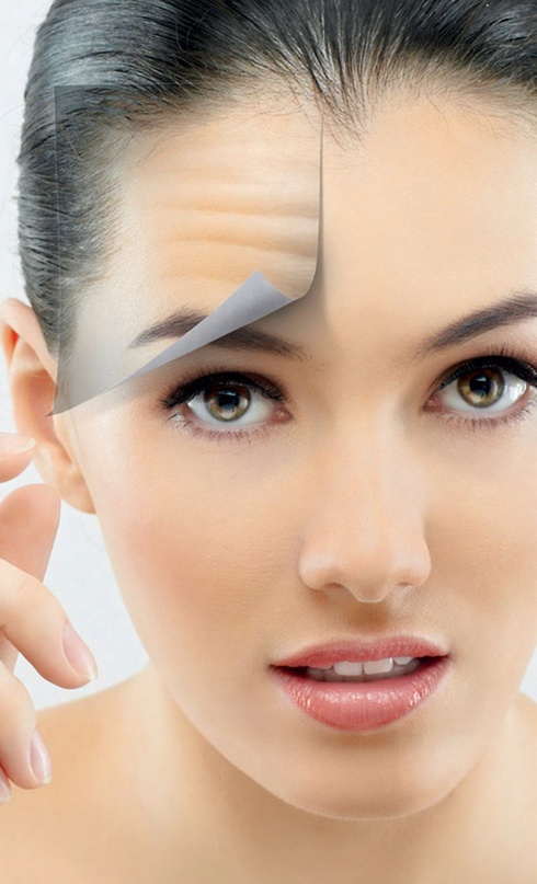 Ботулинотерапия